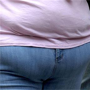 השמנת יתר חולנית – מחלת המאה ה-21